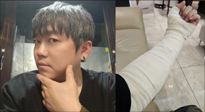 송백경, 창피하다던 문신 드디어 지웠다 "두 아들, 깡패 같아 멋있다고" [전문]