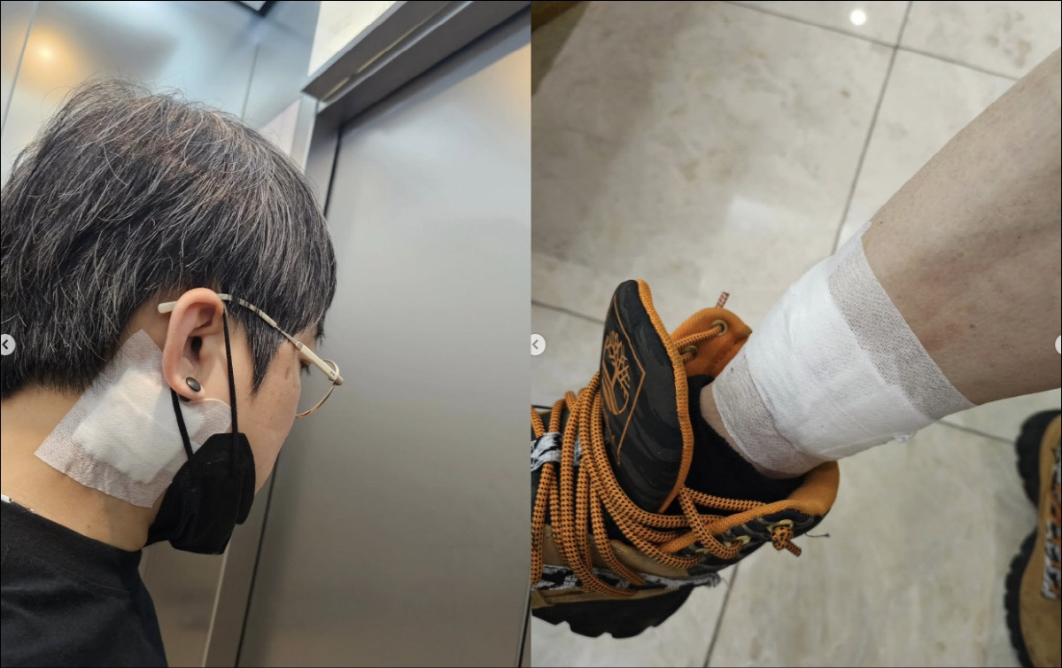 송백경, 창피하다던 문신 드디어 지웠다 "두 아들, 깡패 같아 멋있다고"…