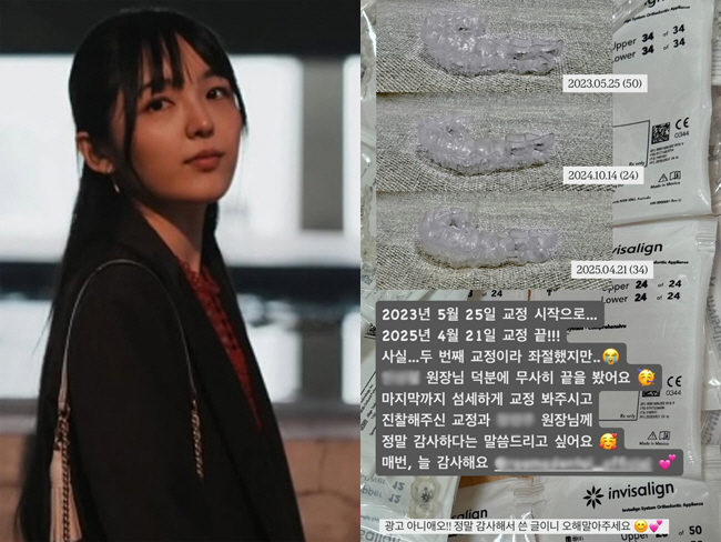 '하이킥' 서신애, 치아 교정 효과 톡톡 "두 번째라 좌절했지만.."