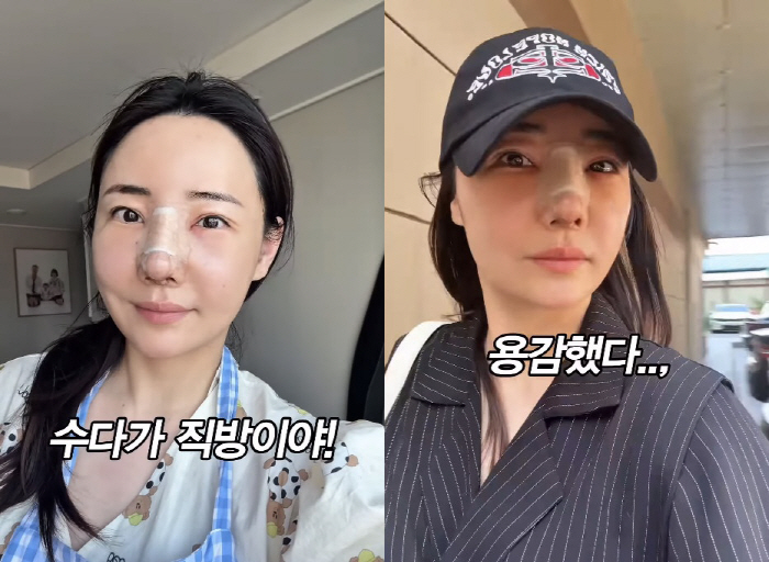 '조혜련 올케' 박혜민, 3번째 코 수술 심한 부기 