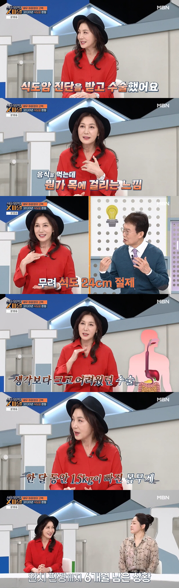 허윤정 "식도암으로 24cm 절제..15kg 급감에 무서웠다"