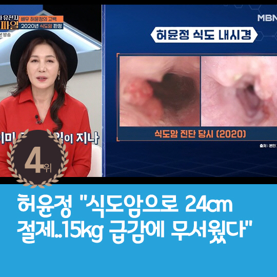 [카드뉴스] 지난주 핫이슈,  오버립 지우고 미모 회복한 박봄