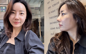 '조혜련 올케' 박혜민, 3번째 코수술 후 반전 미모 