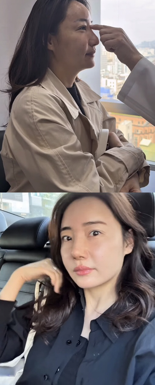 '조혜련 올케' 박혜민, 3번째 코수술 후 반전 미모 "의버지 감사"