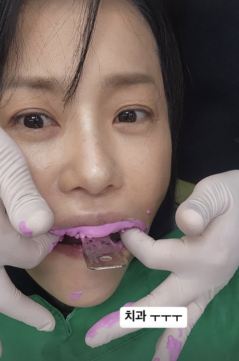 [SCin스타] 고현정, 치과 치료까지 다 보여줬다..세상 털털한 일상