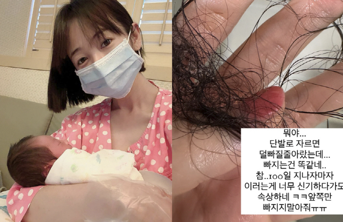 김보미, 둘째 출산 100일만 한 움큼 빠진 머리카락..."앞쪽만 빠지지…