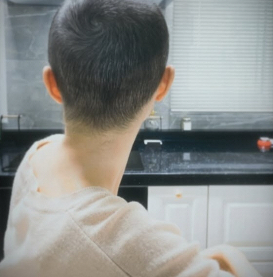 '암 투병' 이솔이, 항암치료 후유증 "눈썹 빠지고 손도 까매져"