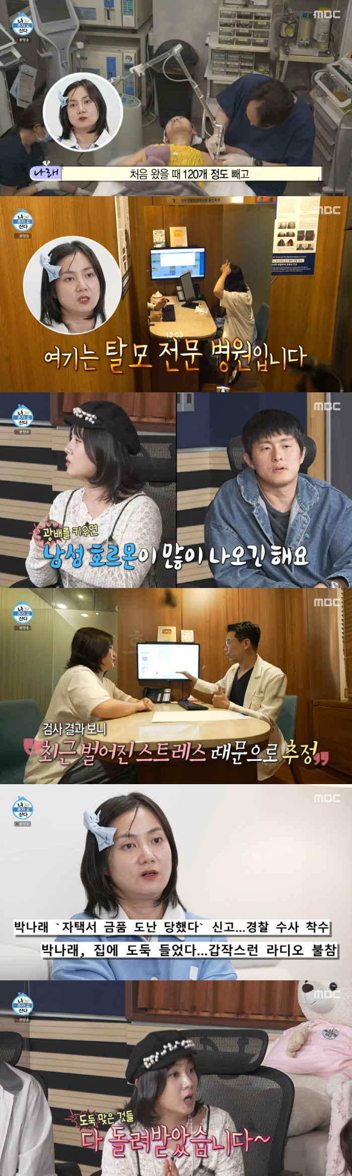 박나래, '자택 도난' 스트레스로 탈모왔다 "남성호르몬도 많아져" ('나…