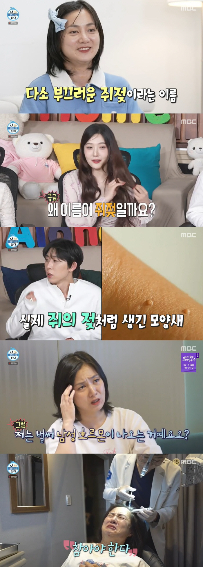 박나래, 쥐젖 200개 제거→탈모 주사 맞았다 "수치스러워" ('나혼산'…