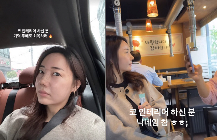 조혜련, 올케 박혜민 '3차 코수술'에 깜짝 "옆라인 진짜 대박"