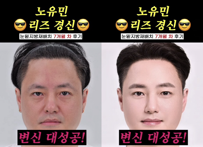 노유민, 커피 팔아 건물주 되더니..눈밑지방+탈모 시술로 리즈 갱신