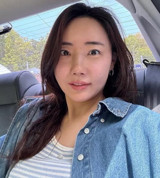 '조혜련 올케' 박혜민, 코수술 후 물오른 미모 "추가 성형? 억울"