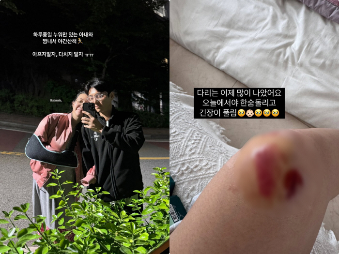 '쌍둥이 임신' 김지혜, 낙상사고로 피멍+흉터 가득..♥최성욱 "아프지 …