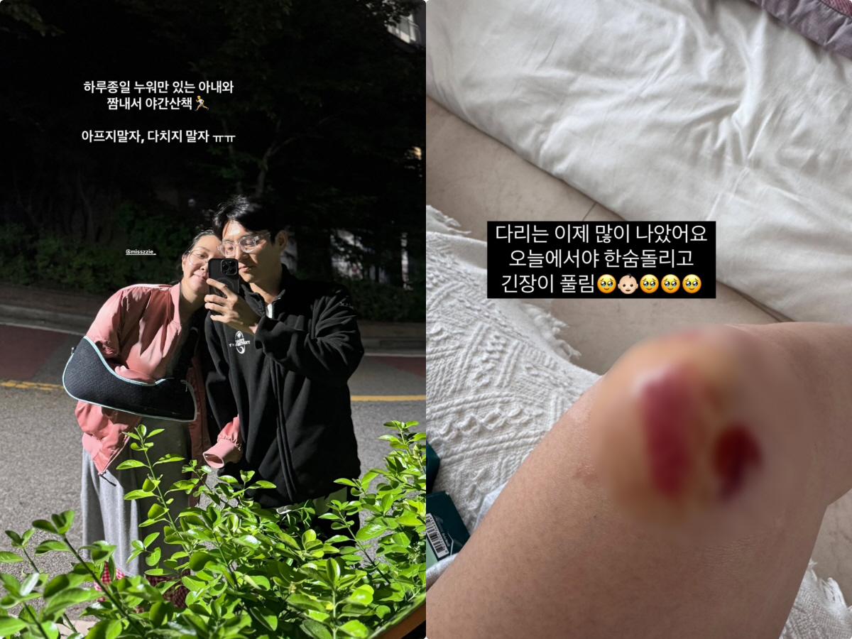 '쌍둥이 임신' 김지혜, 낙상사고로 피멍+흉터 가득..♥최성욱 "아프지 …