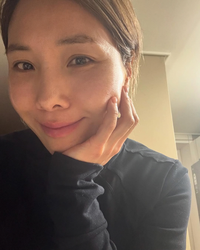 '11㎏ 감량' 신봉선, 확 달라진 얼굴의 비결은 "피부과 레이저 시술"…