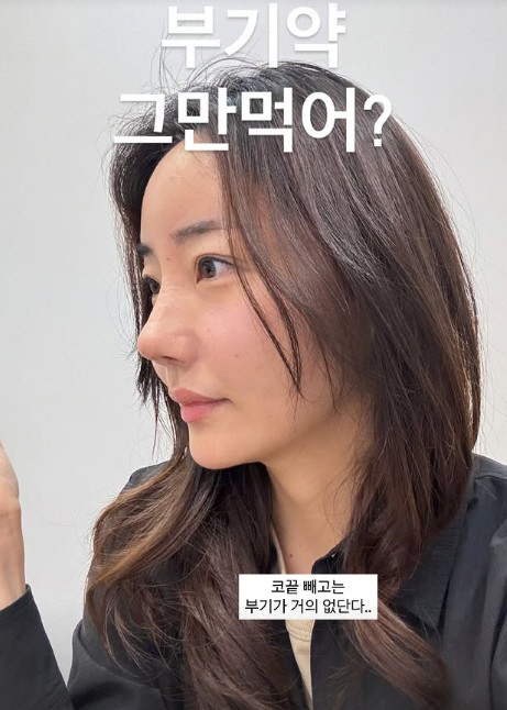 '조혜련 올케' 박혜민, 본인도 만족한 세 번째 코성형..."2차 때는 …