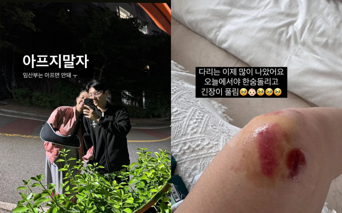 '쌍둥이 임신 중 낙상' 김지혜, 결국 손가락 부상..안타까운 근황