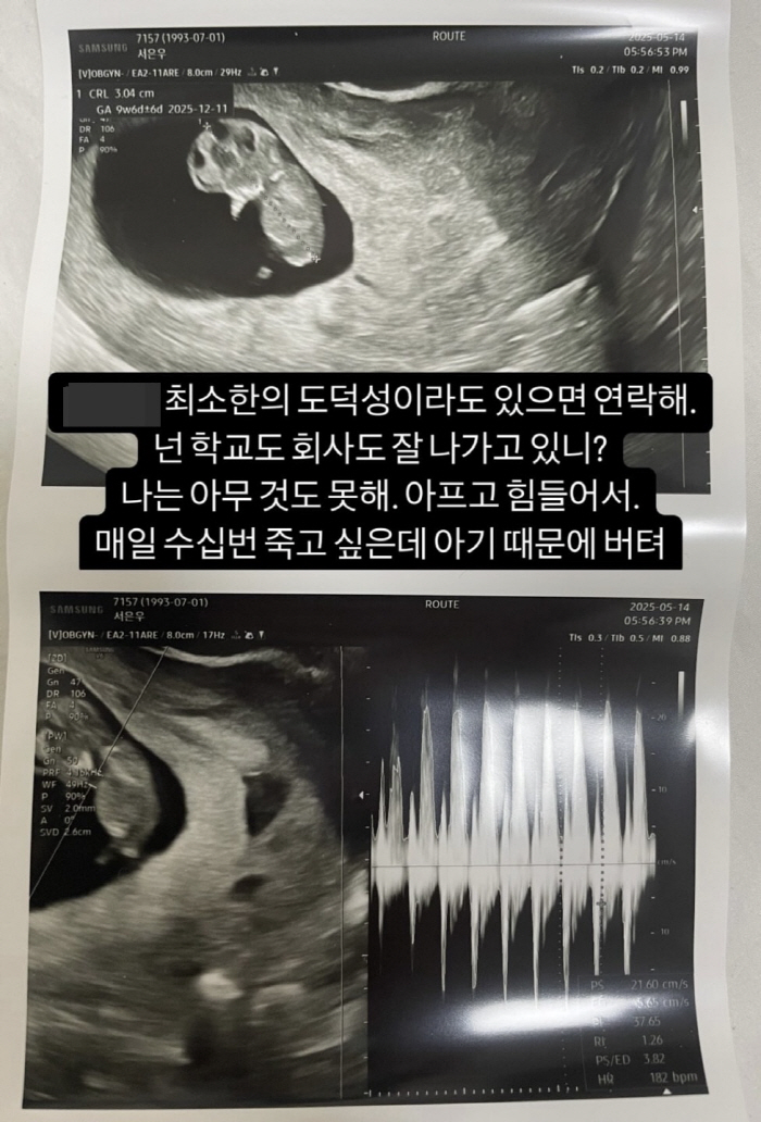 서민재, '임신 갈등' 남친 또 저격 "수십 번 죽고 싶은데 아기 때문에…