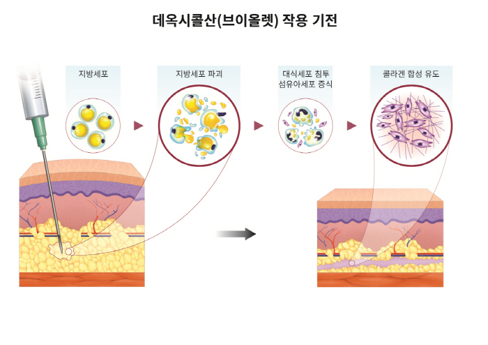 "대웅제약 지방파괴주사제 브이올렛 주성분, 팔뚝살에도 효과"...국내 연…