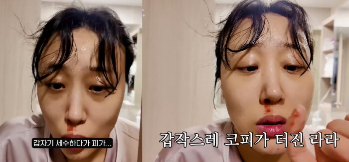 '난임극복' 임라라, 얼굴 피범벅에 경악 "임신 증상이 맞나요?"