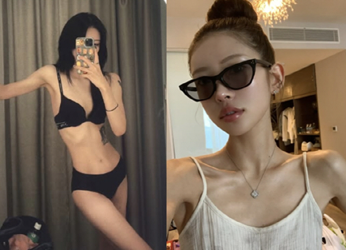'故 최진실 딸' 최준희, 아직 23살인데..."골반 괴사 중" 안타까운…