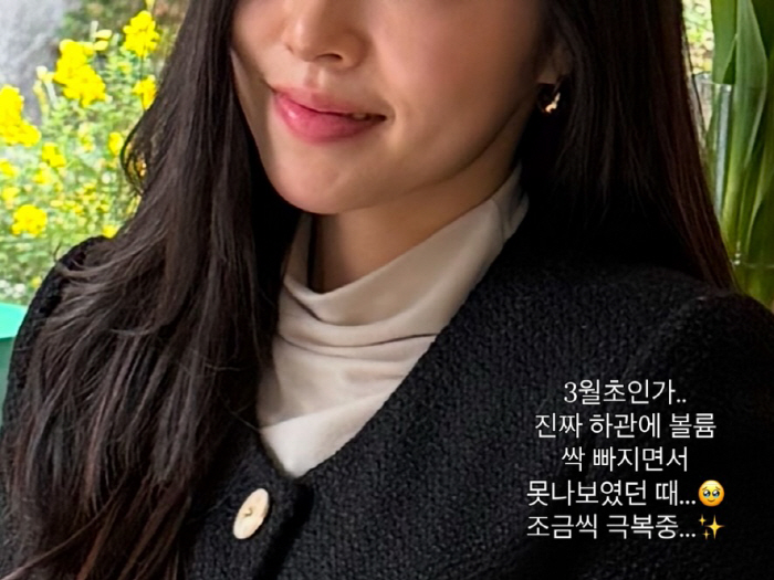 '박성광♥' 이솔이, 암 투병 맘고생 컸나.."하관 볼륨 싹 빠져" 안타…