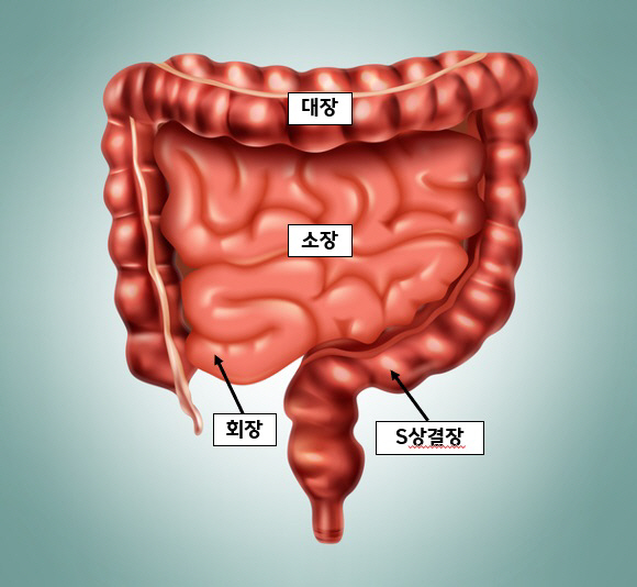 한림대동탄성심병원, 국내 최초 말기암 환자 '초음파내시경 유도하 회장결장…