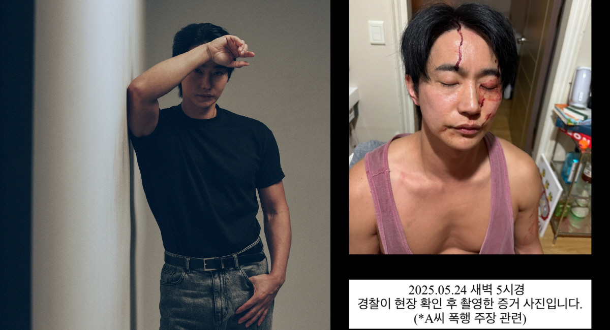 배우 전호준, 전여친 폭행 주장 정면 반박.."살려주세요" 핏자국 선명한…