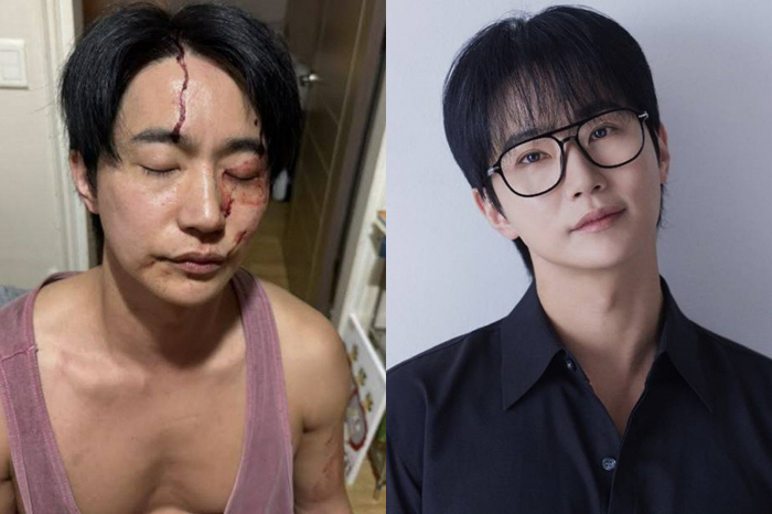 [전문] 전호준, '前여친 폭행+성병 의혹' 입 열었다…