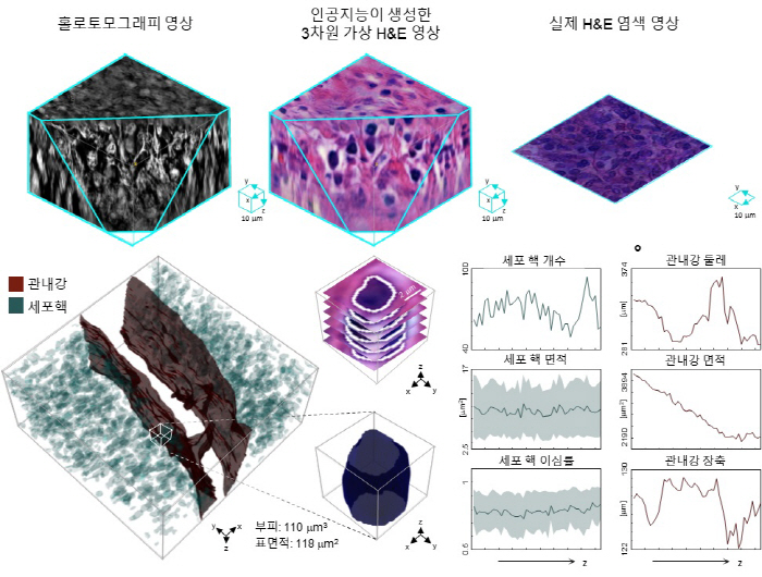 '3D·가상 염색' 기술로 절개 안하고 암 조직 관찰 가능해져