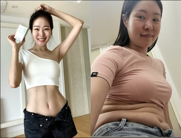 '김태현♥' 미자, 11자 복근 어디 갔어…적나라한 뱃살 공개 충격