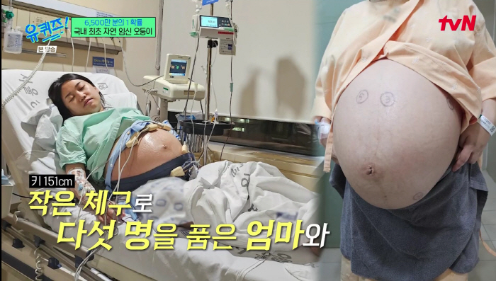 '오둥이 자연임신' 부부 