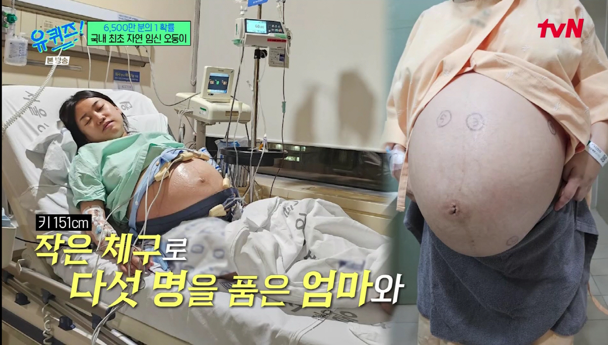 '오둥이 자연임신' 부부 "경제적 두려움에 매일 울어, 선택적 유산 권유…