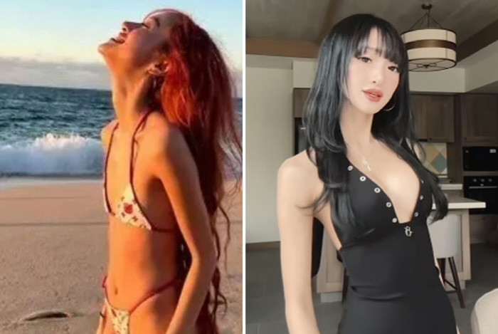 '작은' 가슴으로 유명해진 여성, 유방 확대술 받아…"우리 돈으로 성형?…