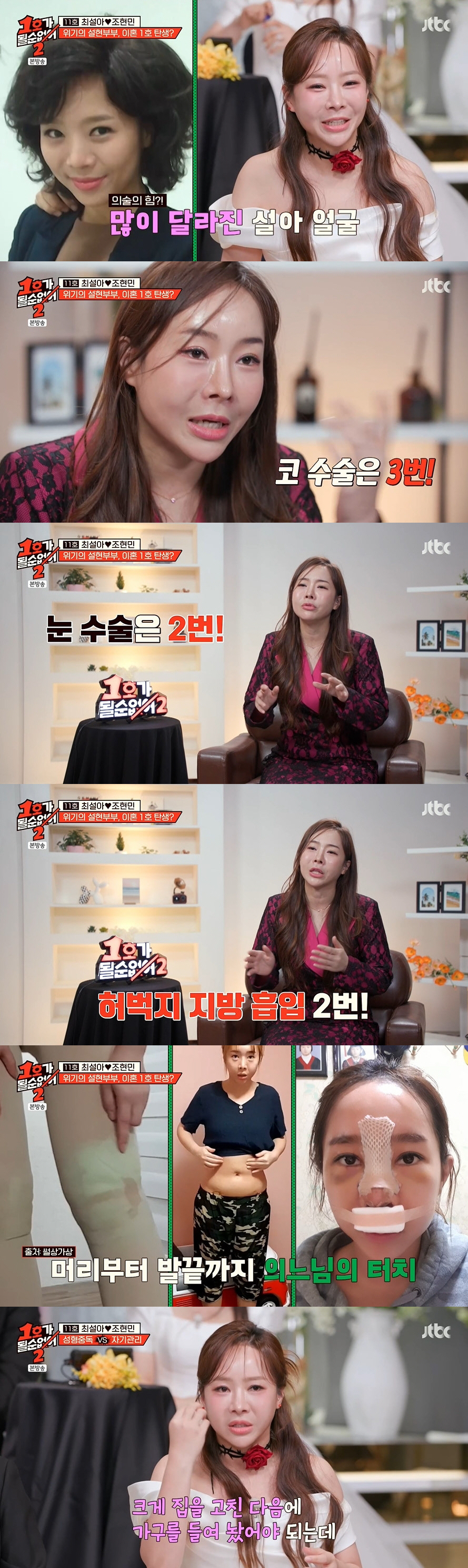 최설아, 심각한 '성형 중독' 고백 "코 수술 3번X눈 수술 2번, 아랫…