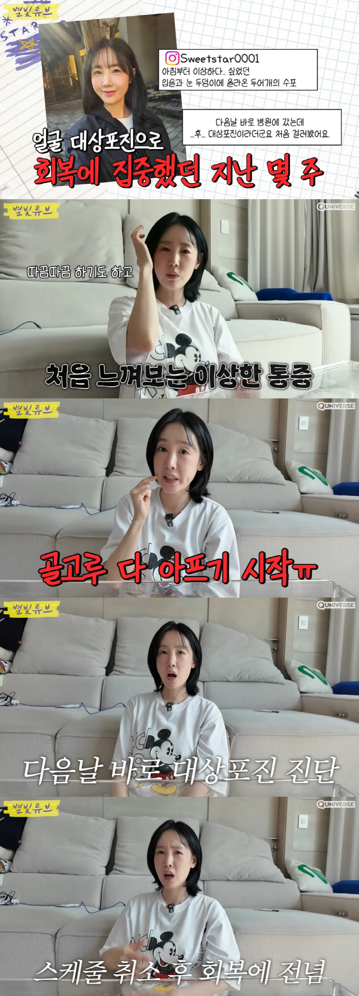 '하하♥' 별, 안면 대상포진에도 스케줄 강행 "수포 번진 오른쪽 얼굴 …