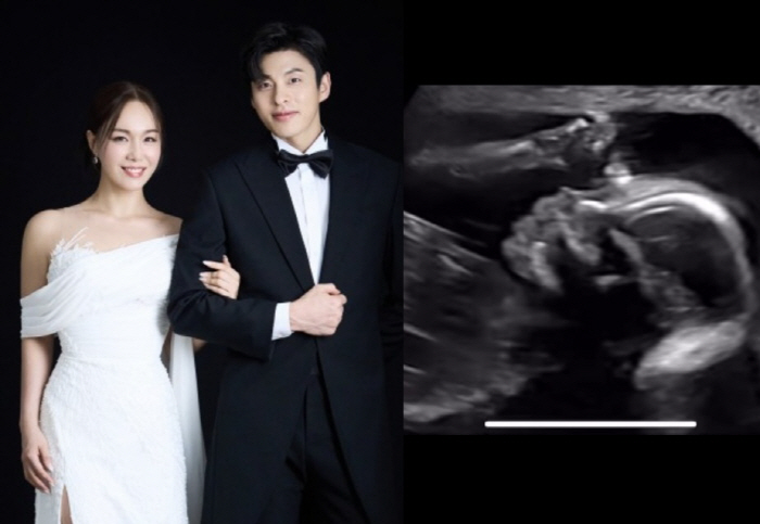 임정희♥발레리노 김희현, 결혼 1년 7개월만 임신 