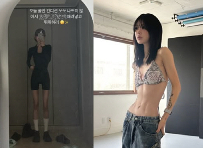 '故 최진실 딸' 최준희, 고작 23살인데...'골반 괴사 진행 중' 안타까운 근황