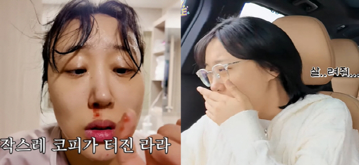 '쌍둥이 임신' 임라라, 코피→심한 입덧...母 되기 쉽지 않네 