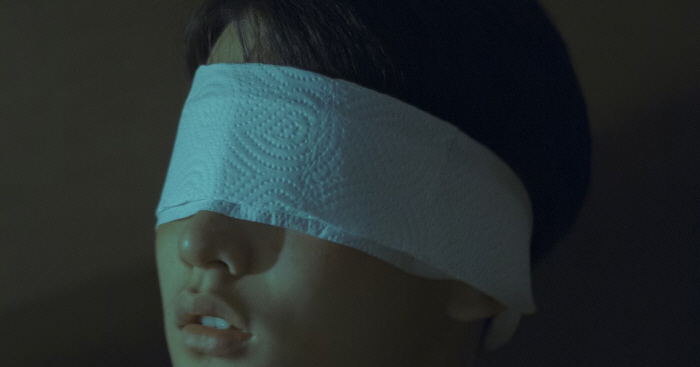눈 다친 후 '망막 합병증' 수개월 후에도 발생…방치 땐 실명 위험 가능…