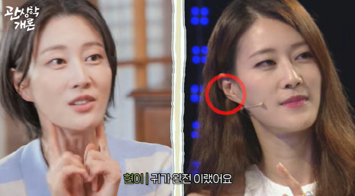 이현이, 귀 필러 고백 "돈 줄줄 샌다는 말에 시술, 효과 있어" ('관…
