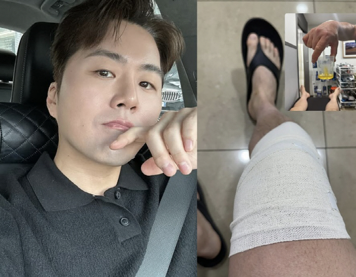 '태진아 子' 이루, 자숙 3년만 안타까운 근황 