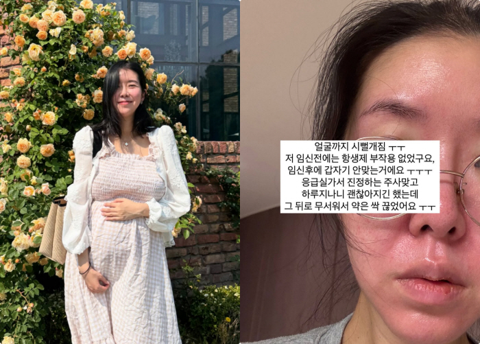 '쌍둥이 임신' 김지혜, 낙상사고 한달 만에 또 응급실 