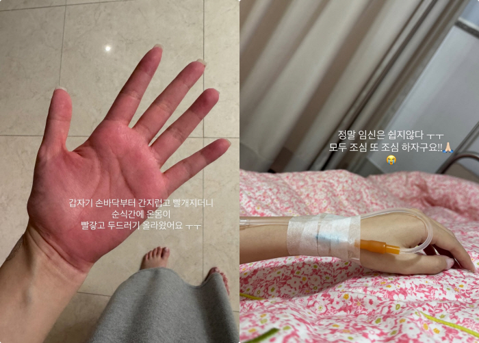 '쌍둥이 임신' 김지혜, 낙상사고 한달 만에 또 응급실 "항생제 부작용,…