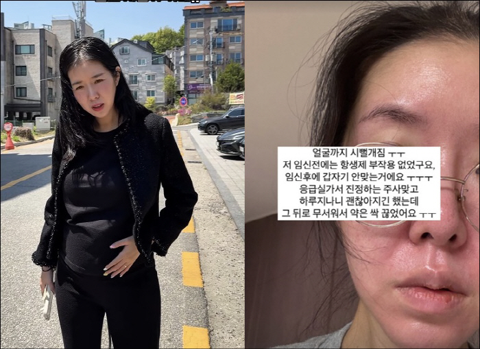 '쌍둥이 낙상사고' 김지혜, 임신 중 약 먹었다가 응급실行 