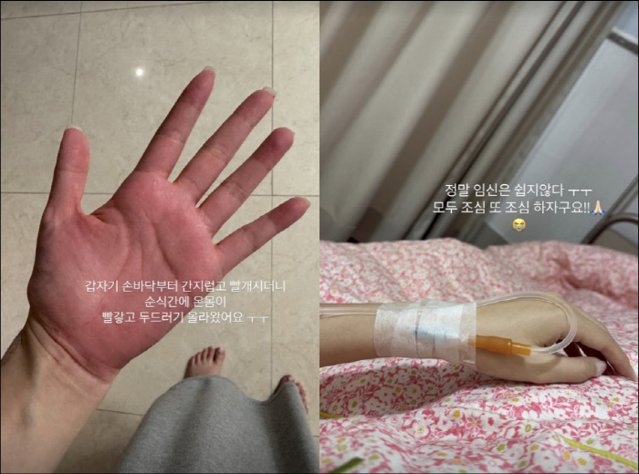 '쌍둥이 낙상사고' 김지혜, 임신 중 약 먹었다가 응급실行 "부작용 없었…