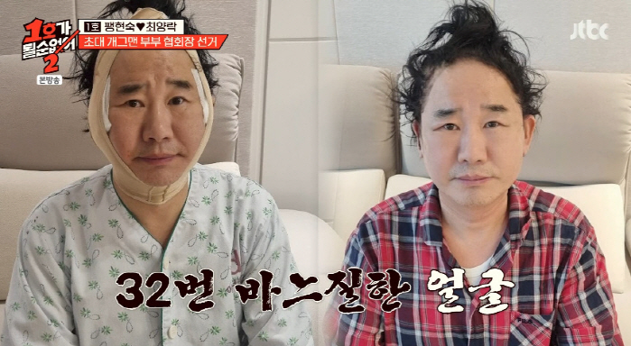 최양락, 쌍꺼풀 수술 2번+안면 거상까지..
