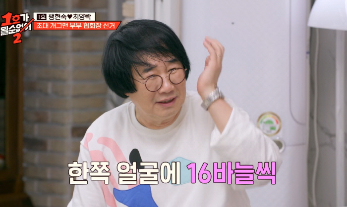 '63세' 최양락, 눈 2번 수술+안면거상에 확 바뀐 얼굴 "페이스오프 …