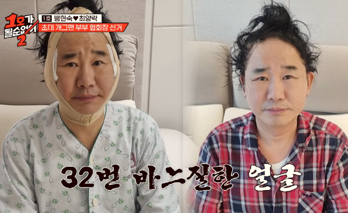 '63세' 최양락, 눈 2번 수술+안면거상에 확 바뀐 얼굴 "페이스오프 …