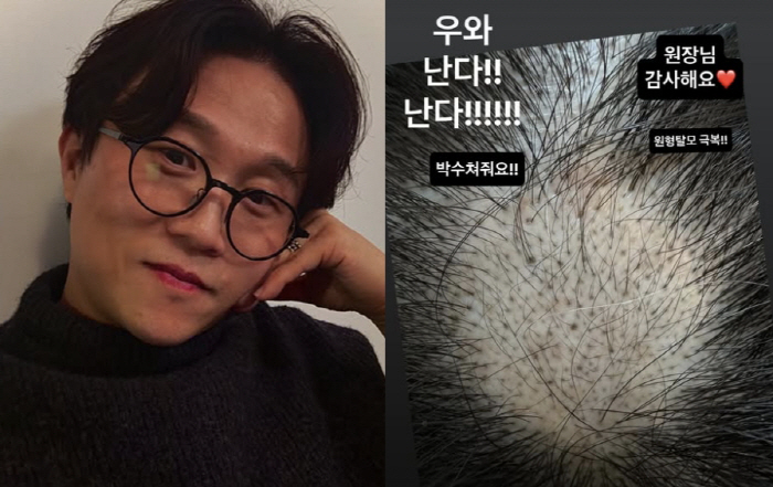 '이솔이♥' 박성광, 병원서 겹경사 터졌다...기적적인 치료 결과 "원형…